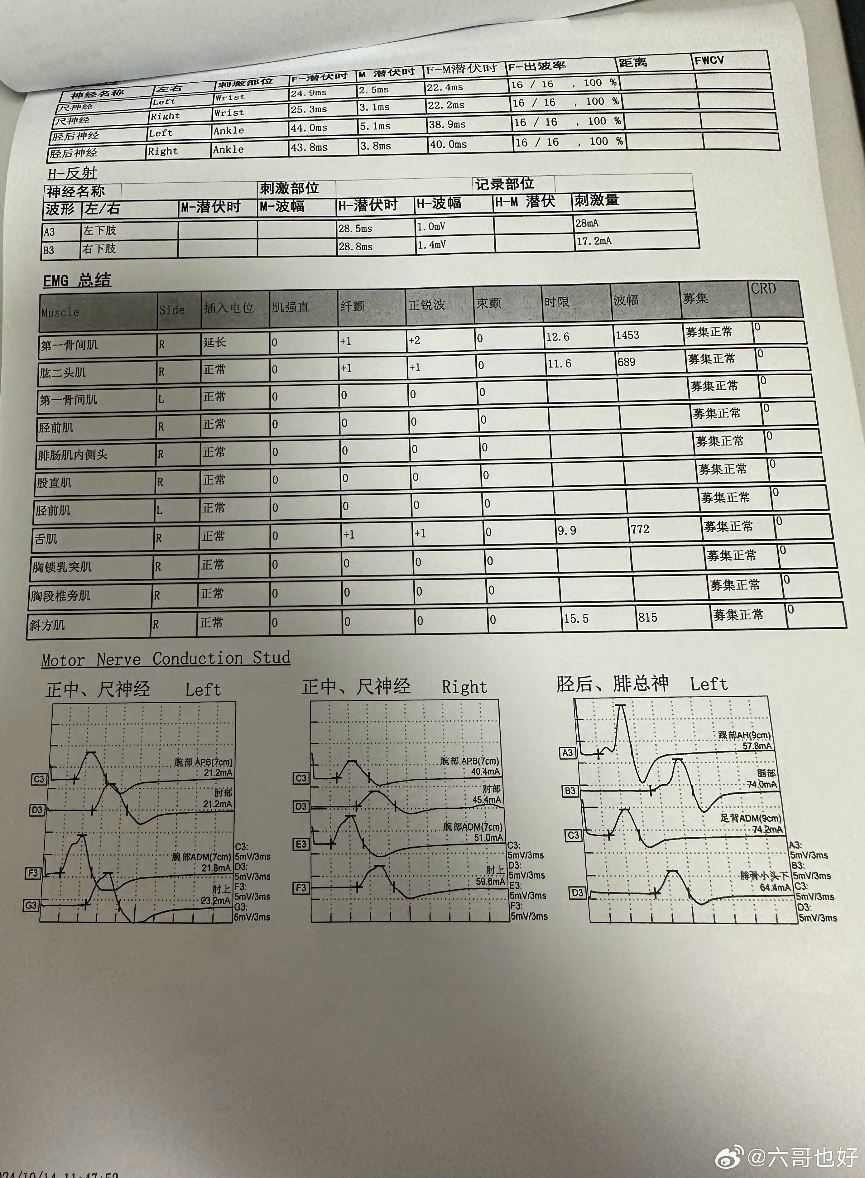 最新病情报表分析与解读报告